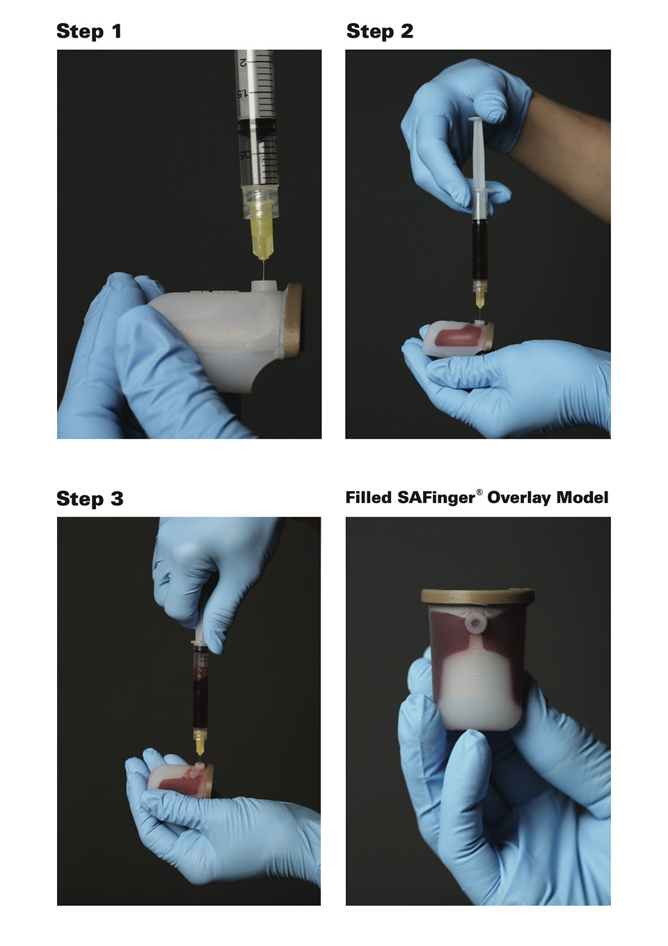 A visual demonstration in 3 steps showing the location of the SAFinger bladder. Please contact us for instructions.